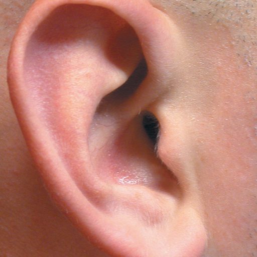 Ear Influxion